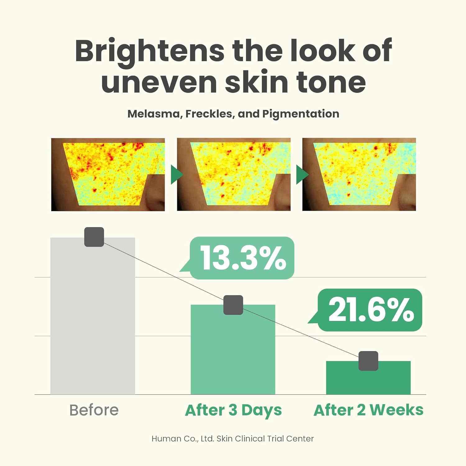 Before and after effects of a skincare product on skin tone, showing a reduction in melasma, freckles, and pigmentation.